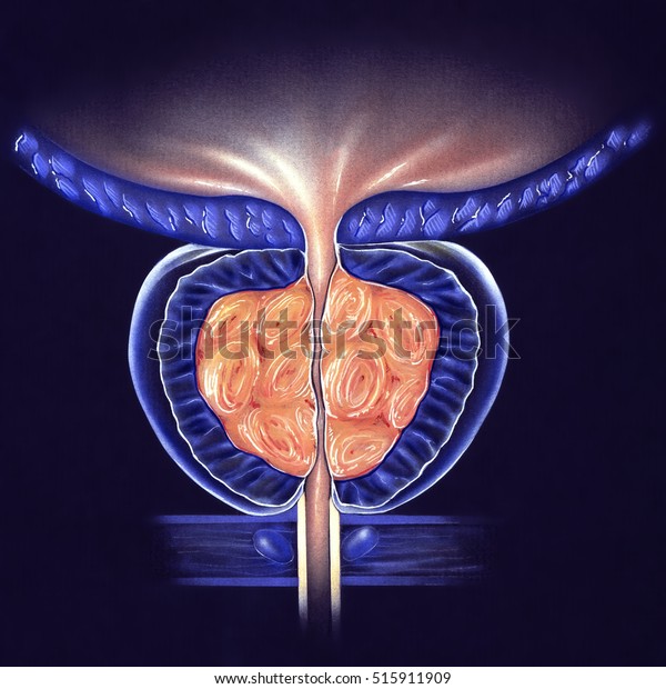 ghiandola prostatica ingrandita ghiandola prostatica ingrandita