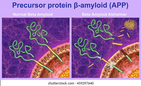 The proteolytic processing of the precursor protein beta-amyloid.