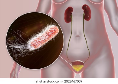 Pseudomonas aeruginosa as a cause of cystitis. Bacterial infection of urinary bladder. Conceptual 3D illustration showing bacteria Pseudomonas aeruginosa in urine