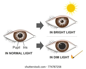 dilated pupils vs normal