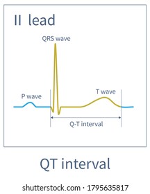 The QT Interval Is The Total Time Of Depolarization And Repolarization Of The Ventricle.