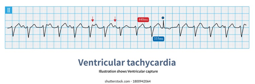 11 Sinus capture Images, Stock Photos & Vectors | Shutterstock