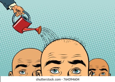 Remedy For Hair Growth. Bald Man Poured From A Watering Can. Pop Art Retro  Illustration