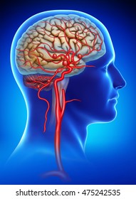 Rendering human head on a blue background with a saccular aneurysm
internal carotid artery
