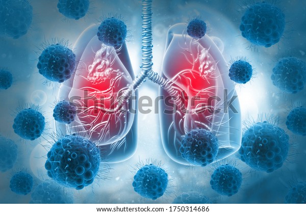 Respiratory virus infection, dangerous\
lung disease, medical background, 3d illustration \
