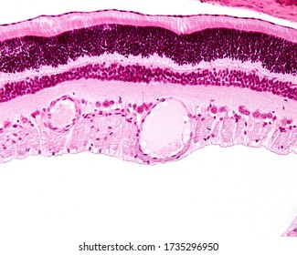 28 Inner nuclear layer Images, Stock Photos & Vectors | Shutterstock