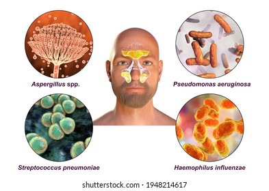 345 Haemophilus influenzae Stock Illustrations, Images & Vectors ...