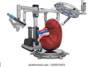 Robotic Surgery Of The Kidney Concept, 3D Rendering Isolated On White Background