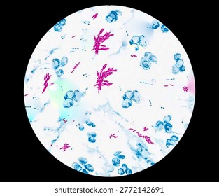 Rods shape bacilli microbacterium tuberculosis bacteria or MTB analysed by microscope.