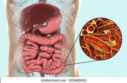 differences between shigella dysentery and shig flex type 3