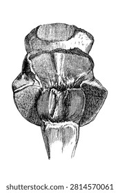 Sagittal section of a hoof with chronic pododermatitis, showing inflammation of the digital cushion and surrounding tissues, old vintage illustration, 1889.