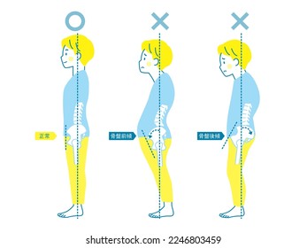 A sample of good and bad posture in men. Translation: "Comparison of anterior and posterior pelvic tilt"