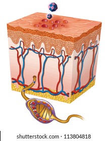 Sample Of Skin Affected By A Herpes Simplex