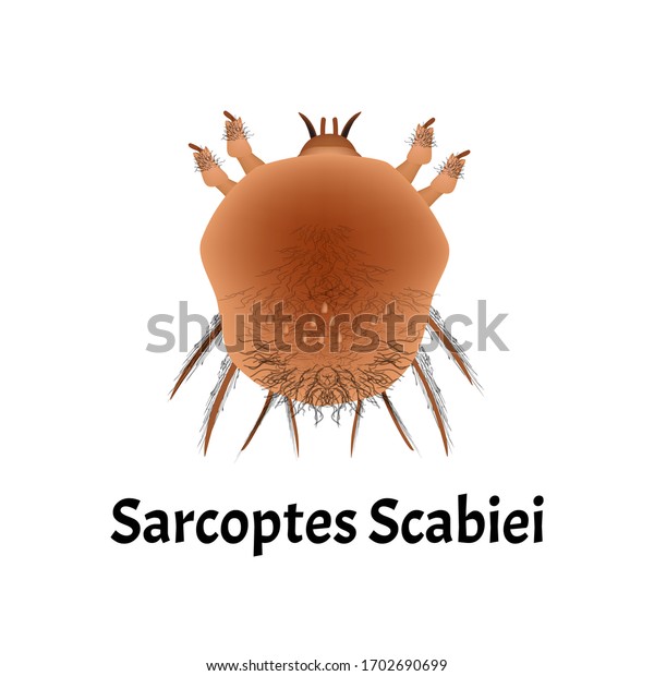 Sarcoptes Scabiei Scabies Sexually Transmitted Disease Stock Illustration 1702690699 Shutterstock 8146