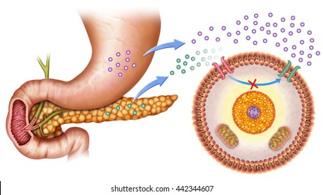 Schematic Illustration Of The Pancreas And Stomach In Insulin Levels And Increased Blood Glucose.