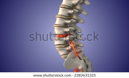 Sciatic nerve pain due to herniated disc 3D Illustration