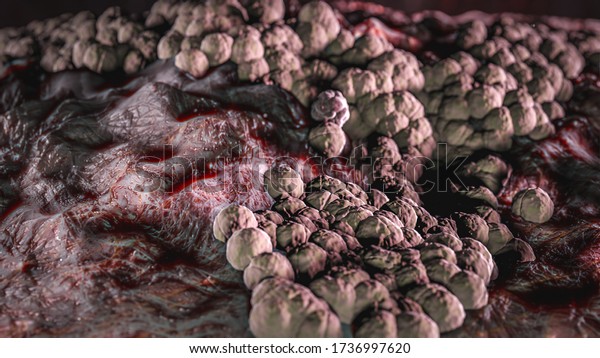 Science Photo of bacteria Candida albicans is\
an opportunistic pathogenic yeast that is a common member of the\
human gut flora 3d\
rendering