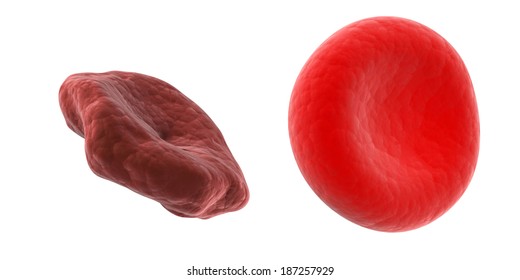 Scientific Illustration - Healthy And Unhealthy Blood Cell