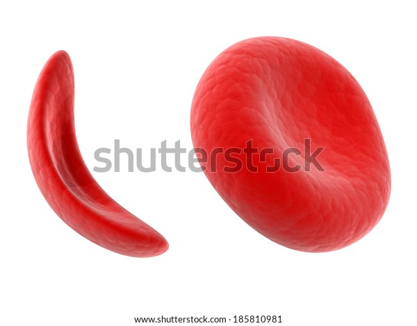 科学イラスト 鎌状赤血球血球 のイラスト素材