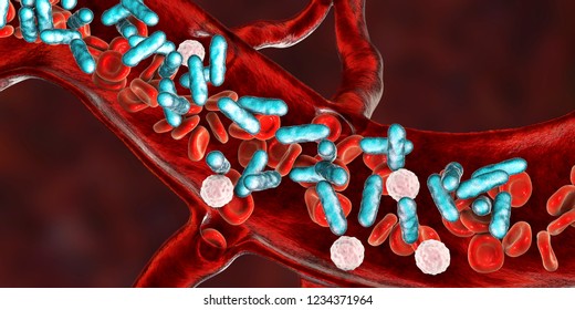 Sepsis, Bacteria In Blood. 3D Illustration Showing Rod-shaped Bacteria With Red Blood Cells And Leukocytes