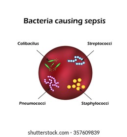 Sepsis. Blood poisoning. E. coli. Streptococci. Pneumococci. Staphylococci. Infographics. illustration.