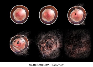 Series of images showing different stages of destruction of a cell. 3D illustration. Can be used to illustrate effect of drugs, medicines, microbes, nanoparticles, apoptosis