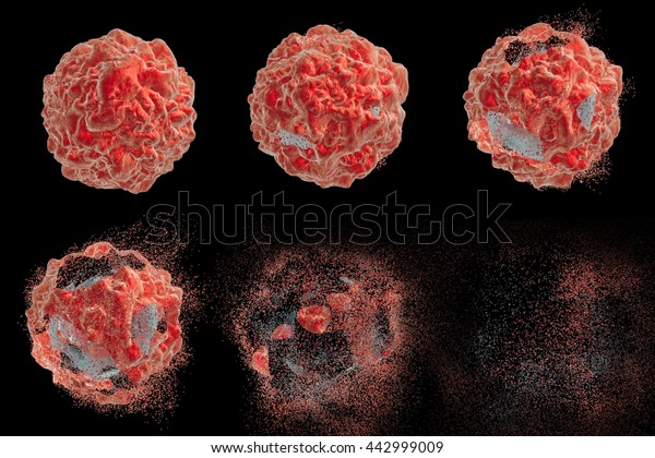 腫瘍細胞の破壊の様々な段階を示す一連の画像 3dイラスト 薬物 医薬品 微生物 ナノ粒子の効果を説明するのに使用できる のイラスト素材