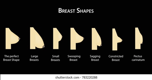 different boob shapes chart
