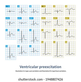 Pr Interval Images, Stock Photos & Vectors 