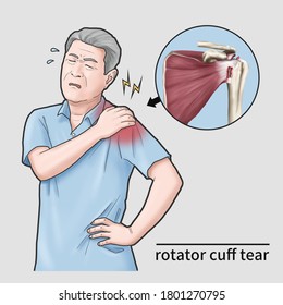 Shoulder Pain Man With Rotator Cuff Tear