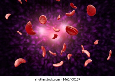 Sickle Cell Anemia Disease (SCD) Blood Cells 3D Illustration