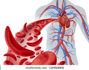 Sickle Cell Heart Circulation And Anemia As A Disease With Normal And Abnormal Hemoglobin In A Human Artery Anatomy With Heart Cardiovascular Medical Illustration Concept In A 3D Render.