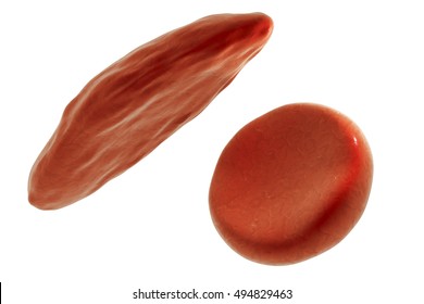 Sickle Cell And Normal Red Blood Cells, 3D Illustration