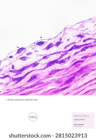 Simple squamous epithelium is a type of covering epithelium; those cells lining the inner surfaces of blood and lymphatic vessels are known as endothelial cells.Magnified 1000x