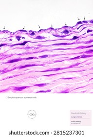 Simple squamous epithelium is a type of covering epithelium; those cells lining the inner surfaces of blood and lymphatic vessels are known as endothelial cells.Magnified 1000x