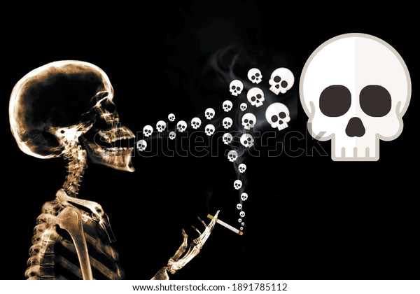手の中のx線の骨格には たばこが入っています 放たれた煙は小さな頭蓋骨の形をしており メディア 芸術 健康に適した大きな頭蓋骨に融合する のイラスト素材