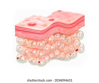 Skin With Acne. 3d Illustration Of The Structure Of The Skin Layers Microstructure.Medical And Educational Pictures Isolated