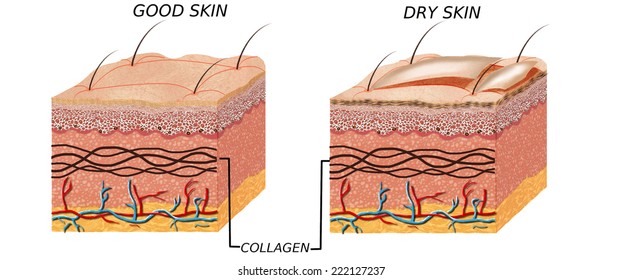 Skin Anatomy Diagram - Comparation Good Skin And Dry.  Illustration Of Skin Cross Section Showing Good Skin And Dry Skin.