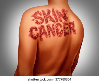 Skin Cancer Melanoma Disease Concept As A Medical Symbol Of The Human Epidermis Anatomy Being Attacked By Malignant Cancerous Dark Mole Shaped As Text On The Body.