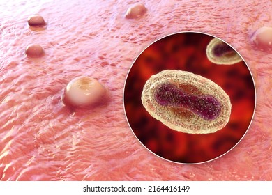 Skin lesions in monkeypox infection and close-up view of monkeypox virus, 3D illustration. A zoonotic virus from Poxviridae family, causes monkeypox, a pox-like disease
