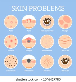 Skin problems. Ages wrinkles problem, face skin infection treatment and dark circles under eyes or black head pores, acne problems. Dermatology health  icons set - Shutterstock ID 1346417780