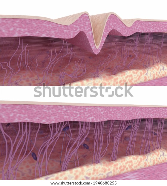 Skin regeneration. Collagen and elastin fibers
renewal process. 3D render. Illustration before and after
rejuvenation skin
treatment.