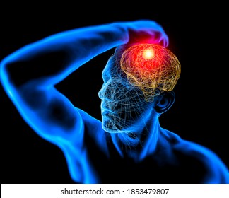 Skull, Pain, Headaches, Neurons, Synapses, Neural Network, Brain, Neuron Circuit, Degenerative Diseases, Parkinson's Disease. Person With Headache, Pain In The Back Of The Head, 3d Render