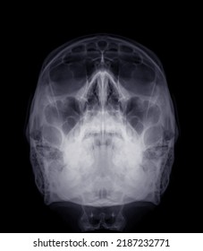 Skull Xray Image Human Waters View Stock Illustration 2187232771 ...