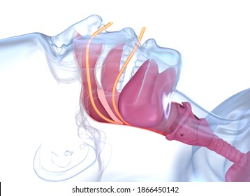 Sleep Apnea Syndrome. Labeled Nasal Tongue Blocked Airway, 3D Animation