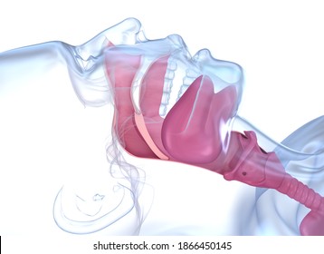 Sleep Apnea Syndrome. Labeled Nasal Tongue Blocked Airway, 3D Animation