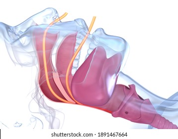 Sleep Apnea Syndrome. Labeled Nasal Tongue Blocked Airway, 3D Illustration