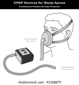 Sleep Apnea Therapy. CPAP Machine With Flexible Air Hose, Nose - Mouth Face Mask On Model. Continuous Positive Air Pressure For Treatment Of Sleep Apnea And Hypopnea.