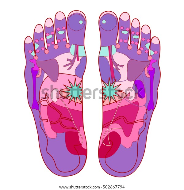 Sole Acupuncture Points Stock Illustration 502667794 | Shutterstock