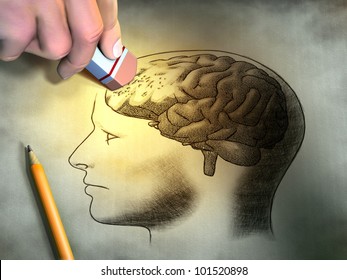 Someone Is Erasing A Drawing Of The Human Brain. Conceptual Image Relating To Dementia And Memory Loss. Digital Illustration.